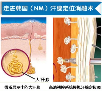 去除狐臭的简单方法.jpg